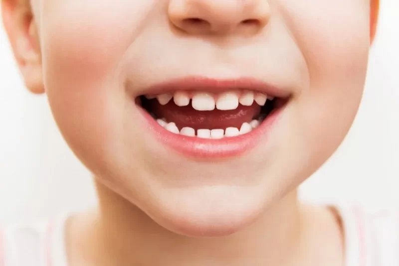 Зачем человеку молочные зубы